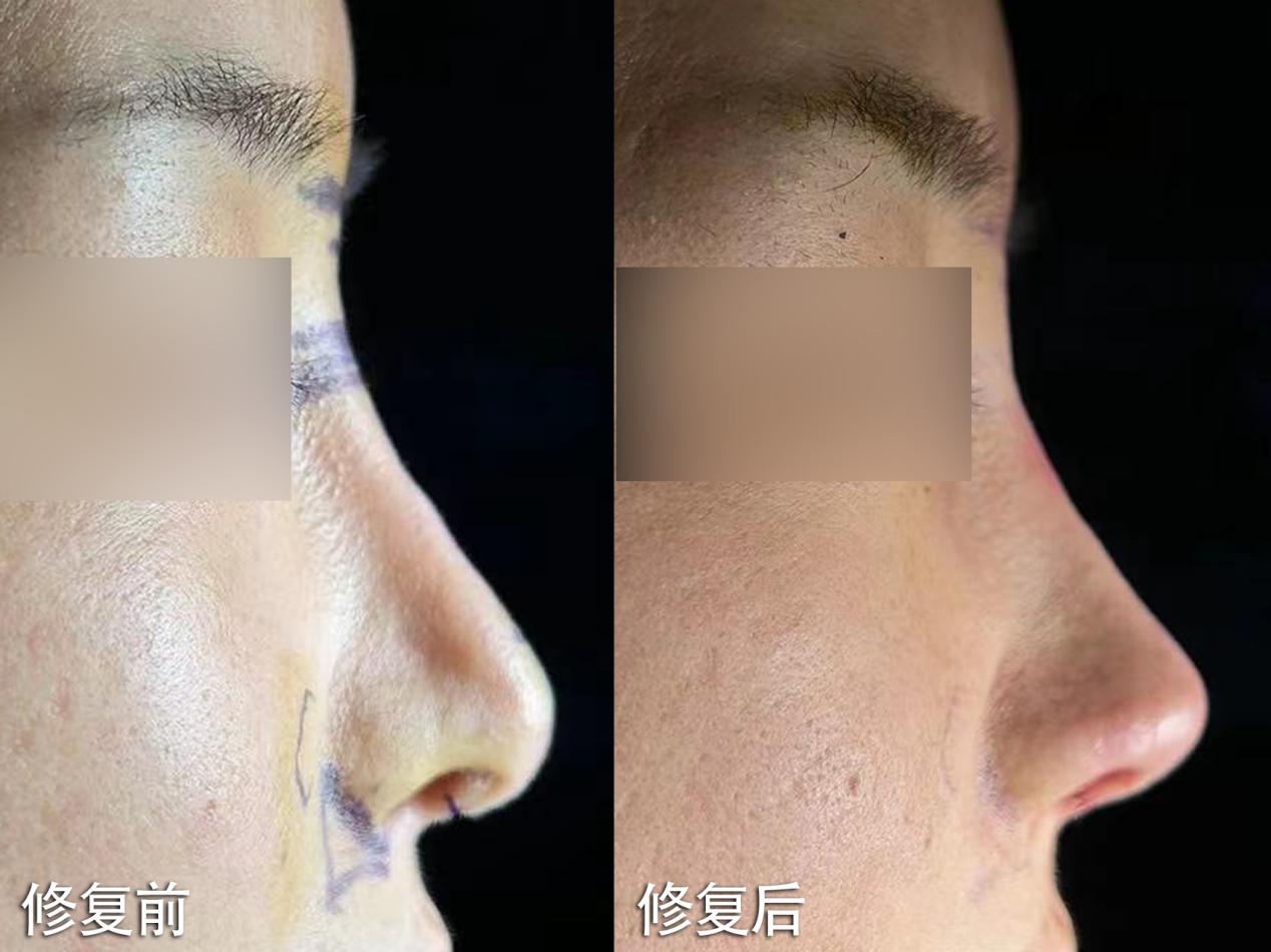 前沿疤痕修复技术，重塑美丽新篇章的科技奇迹，重塑肌肤光彩的奇迹力量